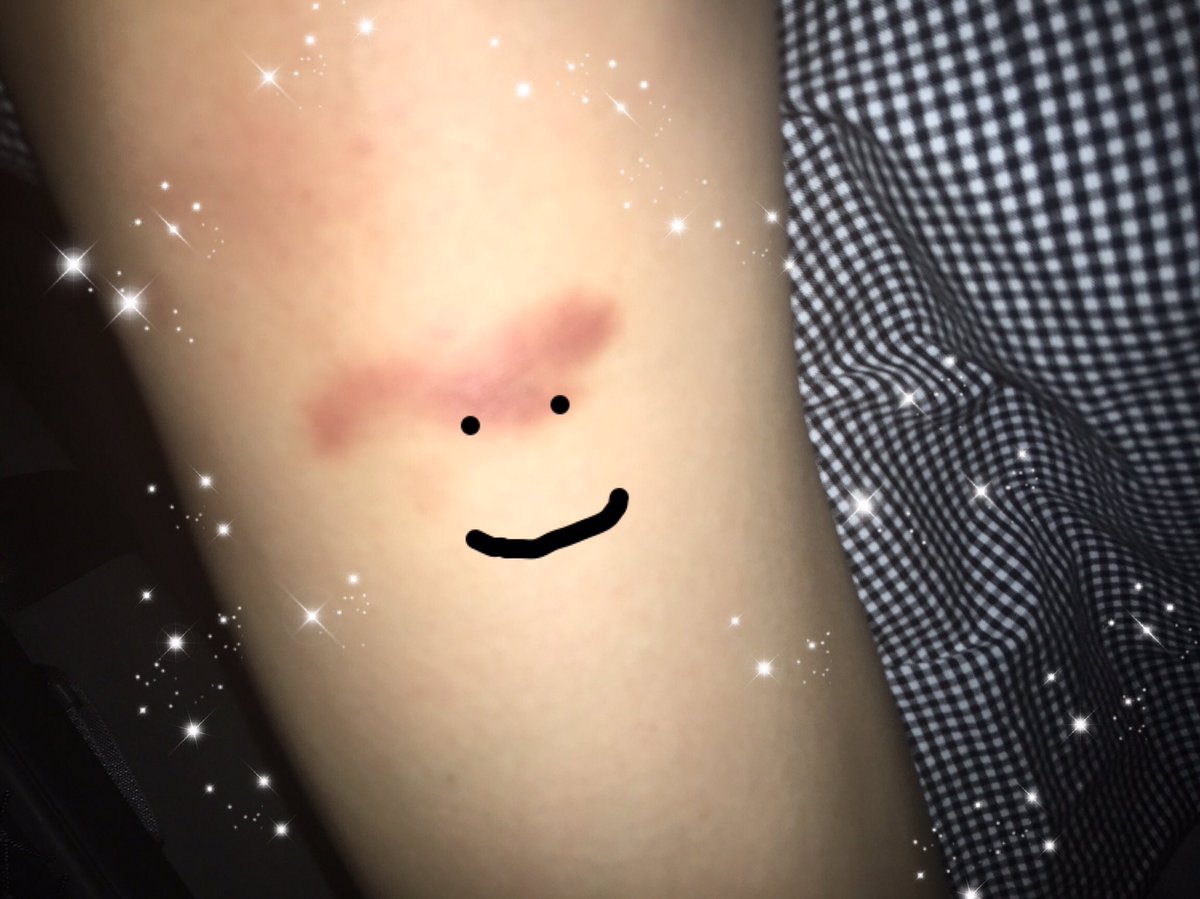 inj